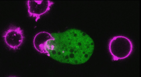 ¿Puede ser el cáncer una enfermedad parasitaria? Recientes investigaciones aseguran que sí